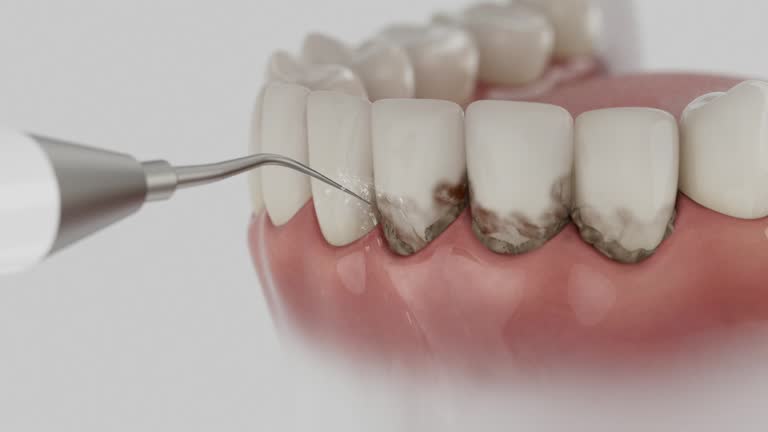 Trusted Dental Implants service in Farm Loop, AK - Dentist Open Now